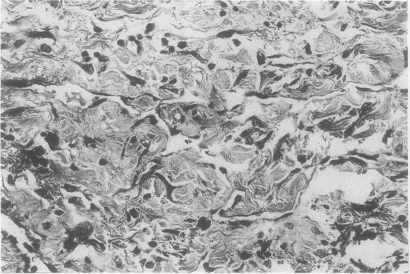 https://cdn.ncbi.nlm.nih.gov/pmc/blobs/4efd/460697/3c8b47d938b9/thorax00256-0024-b.jpg