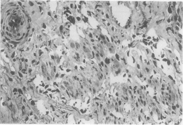 https://cdn.ncbi.nlm.nih.gov/pmc/blobs/4efd/460697/4aa9bc4aecfb/thorax00256-0024-a.jpg