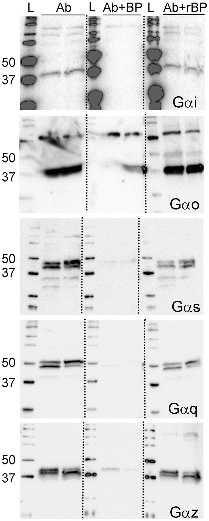 https://cdn.ncbi.nlm.nih.gov/pmc/blobs/4f02/5486491/adb0f452d935/10.1177_1744806917715210-fig1.jpg