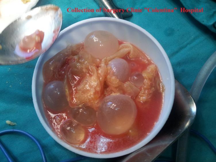 https://cdn.ncbi.nlm.nih.gov/pmc/blobs/4f03/6197524/9fad7a874fab/JMedLife-11-203-g001.jpg