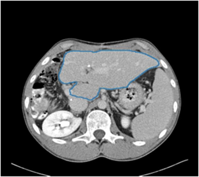 https://cdn.ncbi.nlm.nih.gov/pmc/blobs/4f05/11500357/50de8b828688/41597_2024_3977_Fig9_HTML.jpg