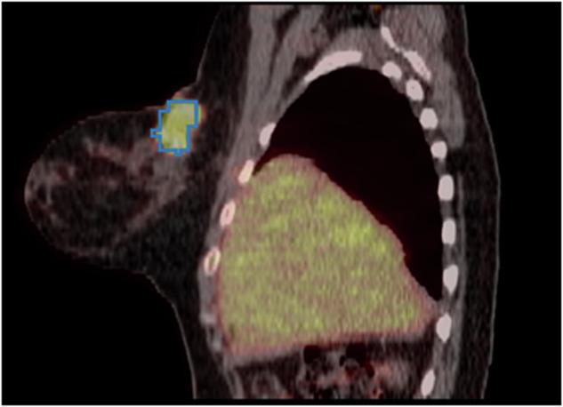https://cdn.ncbi.nlm.nih.gov/pmc/blobs/4f05/11500357/677e68684d66/41597_2024_3977_Fig5_HTML.jpg