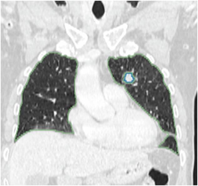 https://cdn.ncbi.nlm.nih.gov/pmc/blobs/4f05/11500357/8d9376a533c5/41597_2024_3977_Fig4_HTML.jpg