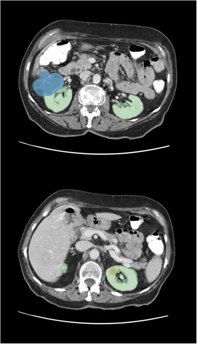 https://cdn.ncbi.nlm.nih.gov/pmc/blobs/4f05/11500357/e535b0e400a2/41597_2024_3977_Fig6_HTML.jpg