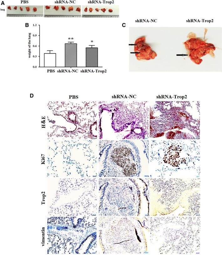 https://cdn.ncbi.nlm.nih.gov/pmc/blobs/4f07/6434498/20aef0bf54e8/CAM4-8-1135-g004.jpg
