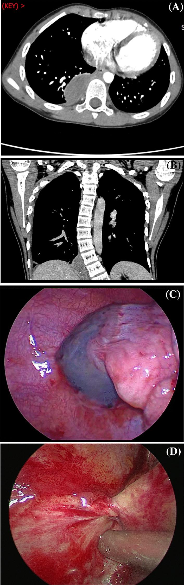 https://cdn.ncbi.nlm.nih.gov/pmc/blobs/4f09/9241176/eee13b709fa7/13019_2022_1921_Fig1_HTML.jpg