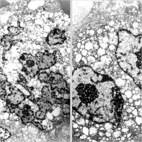 https://cdn.ncbi.nlm.nih.gov/pmc/blobs/4f0a/2782216/18f5dfad688e/jkms-20-516-g005.jpg