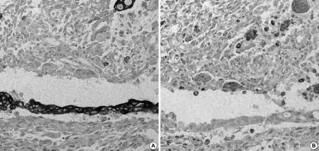 https://cdn.ncbi.nlm.nih.gov/pmc/blobs/4f0a/2782216/c3c961eae22f/jkms-20-516-g003.jpg
