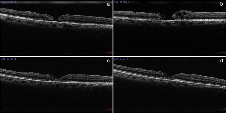 https://cdn.ncbi.nlm.nih.gov/pmc/blobs/4f12/4550061/17b8f756d670/12886_2015_104_Fig2_HTML.jpg