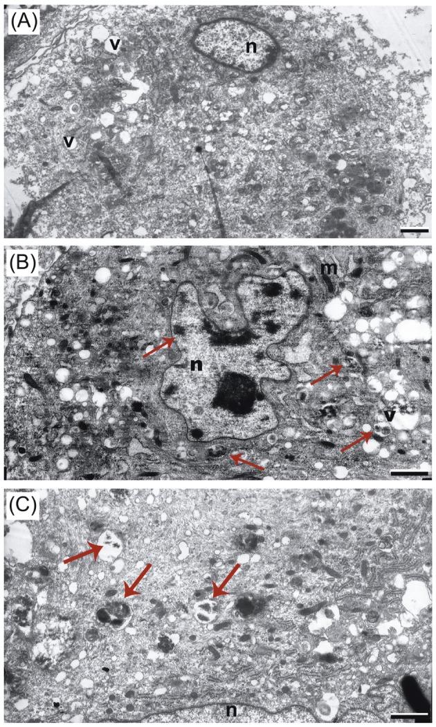 https://cdn.ncbi.nlm.nih.gov/pmc/blobs/4f14/6438124/d0fc0a7eaab0/turkjbio-42-435-g004.jpg