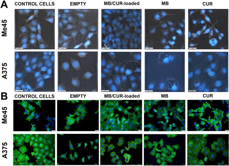 https://cdn.ncbi.nlm.nih.gov/pmc/blobs/4f1d/11131132/67e27e664481/IJN-19-4701-g0007.jpg