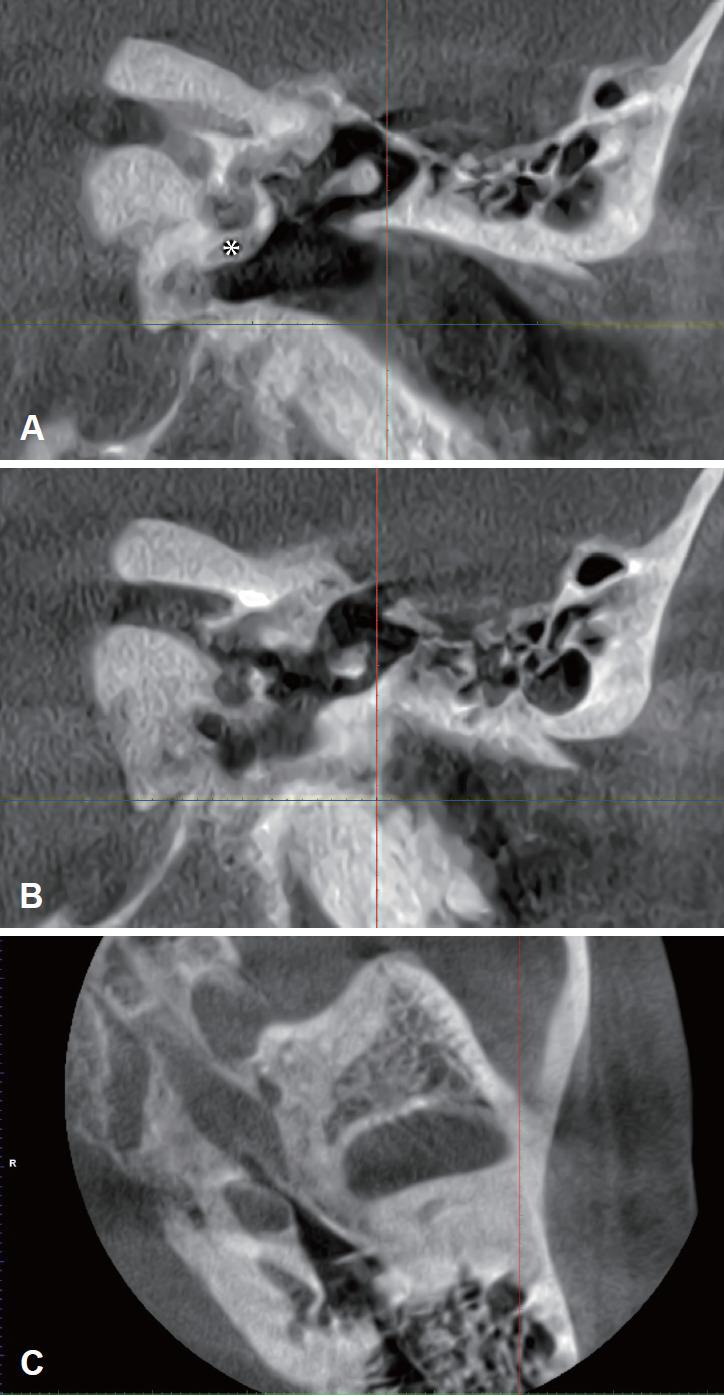 https://cdn.ncbi.nlm.nih.gov/pmc/blobs/4f26/8996086/d56e31a3e9b1/jao-2021-00388f1.jpg