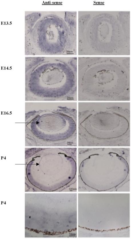 https://cdn.ncbi.nlm.nih.gov/pmc/blobs/4f2b/2868029/12f554ba2866/pone.0010565.g002.jpg