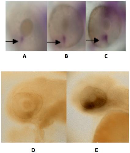 https://cdn.ncbi.nlm.nih.gov/pmc/blobs/4f2b/2868029/6550d4a1ab56/pone.0010565.g010.jpg