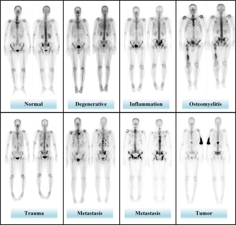 https://cdn.ncbi.nlm.nih.gov/pmc/blobs/4f2e/11156776/da239e24f049/gr2.jpg