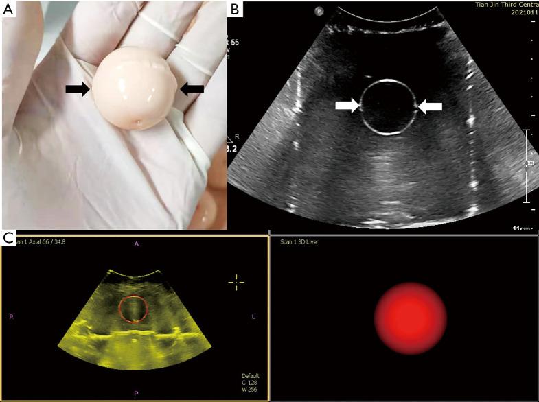 https://cdn.ncbi.nlm.nih.gov/pmc/blobs/4f32/7944255/f5a4723636a8/atm-09-04-354-f3.jpg