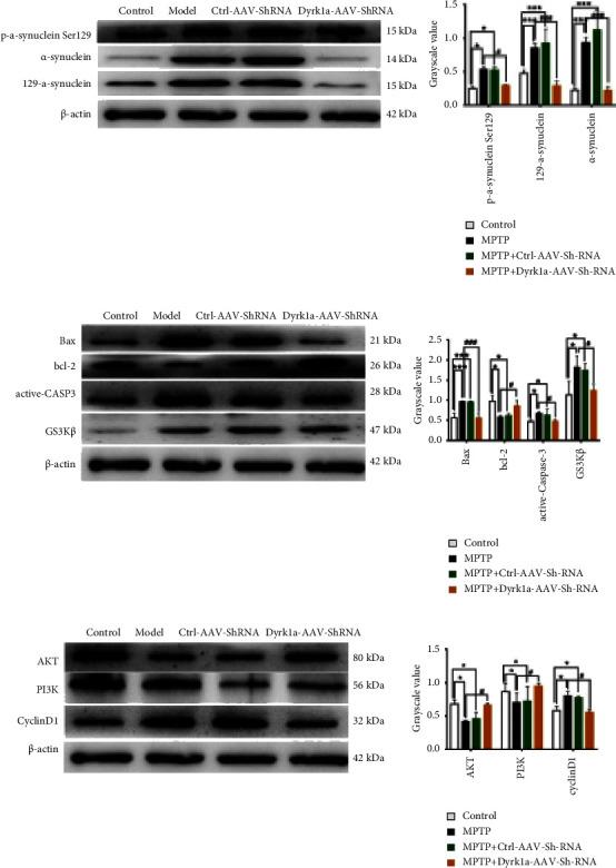 https://cdn.ncbi.nlm.nih.gov/pmc/blobs/4f34/10352525/71122c134c8d/PD2023-8848642.004.jpg