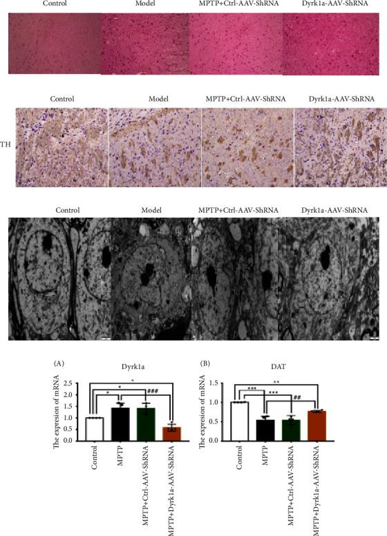 https://cdn.ncbi.nlm.nih.gov/pmc/blobs/4f34/10352525/c820feeafaf6/PD2023-8848642.003.jpg