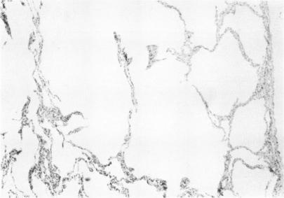 https://cdn.ncbi.nlm.nih.gov/pmc/blobs/4f37/287986/3875660c6ee0/cardiodis00004-0029-c.jpg
