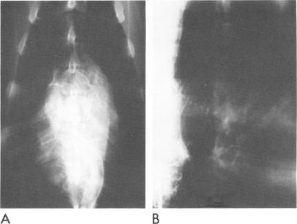https://cdn.ncbi.nlm.nih.gov/pmc/blobs/4f37/287986/82b9deb5bf34/cardiodis00004-0034-a.jpg