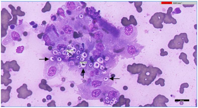 https://cdn.ncbi.nlm.nih.gov/pmc/blobs/4f3a/12470549/953c9ea95c02/jof-11-00672-g003.jpg