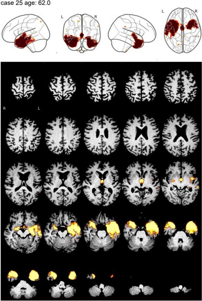 https://cdn.ncbi.nlm.nih.gov/pmc/blobs/4f3b/11166757/39cee3fe1c5f/330_2023_10356_Fig2_HTML.jpg