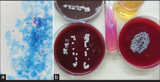 https://cdn.ncbi.nlm.nih.gov/pmc/blobs/4f3b/5565894/28a1b344a199/IJO-65-371-g004.jpg