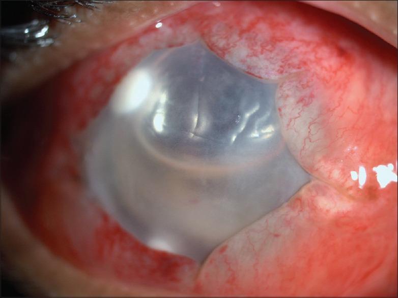 https://cdn.ncbi.nlm.nih.gov/pmc/blobs/4f3b/5565894/4cd325bbd8ee/IJO-65-371-g002.jpg