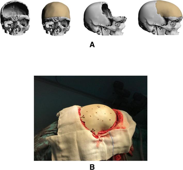 https://cdn.ncbi.nlm.nih.gov/pmc/blobs/4f3b/7239988/3677e8ab7361/40902_2020_262_Fig4_HTML.jpg