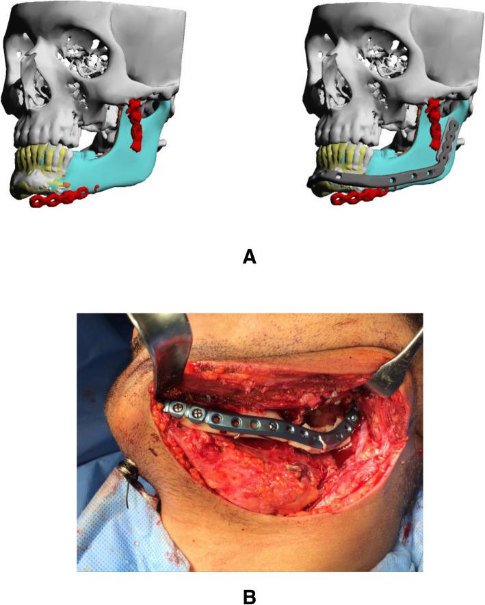 https://cdn.ncbi.nlm.nih.gov/pmc/blobs/4f3b/7239988/e37d161f8564/40902_2020_262_Fig6_HTML.jpg