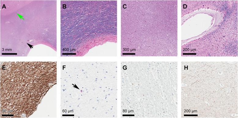 https://cdn.ncbi.nlm.nih.gov/pmc/blobs/4f40/8278704/2f35d288f5de/13195_2021_869_Fig3_HTML.jpg