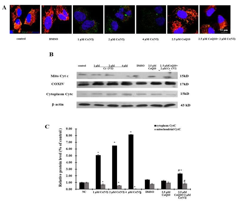 https://cdn.ncbi.nlm.nih.gov/pmc/blobs/4f44/5412400/af7b62746f6c/ijms-18-00816-g005.jpg