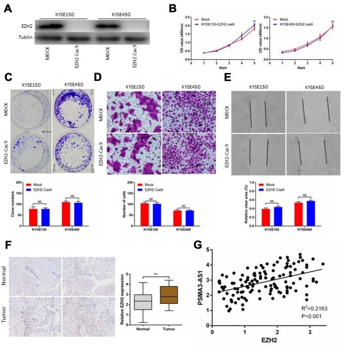 https://cdn.ncbi.nlm.nih.gov/pmc/blobs/4f48/7053621/641f298fdb79/aging-12-102716-g006.jpg