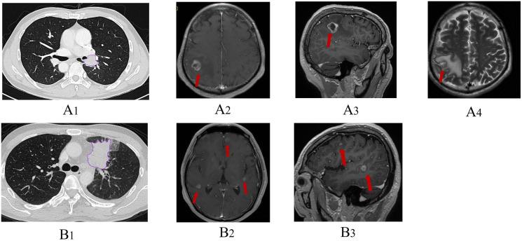 https://cdn.ncbi.nlm.nih.gov/pmc/blobs/4f4e/12213897/beed57d69235/fonc-15-1585930-g002.jpg