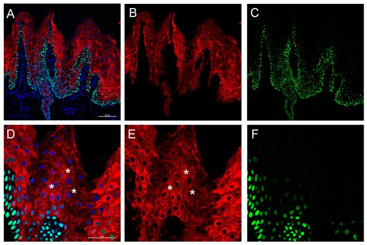 https://cdn.ncbi.nlm.nih.gov/pmc/blobs/4f52/8269197/5a384c870485/ijms-22-06901-g005.jpg