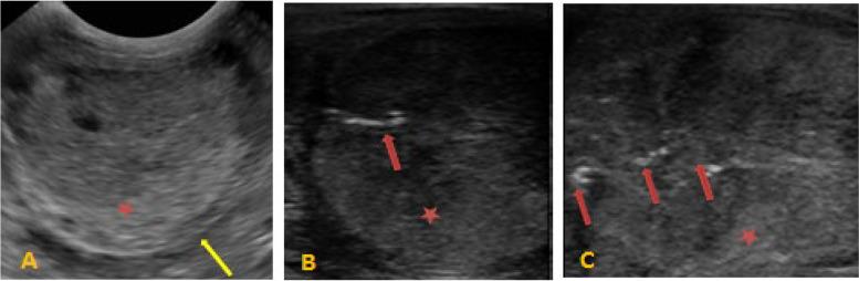 https://cdn.ncbi.nlm.nih.gov/pmc/blobs/4f54/10474774/0aa3e8c267df/12917_2023_3694_Fig2_HTML.jpg