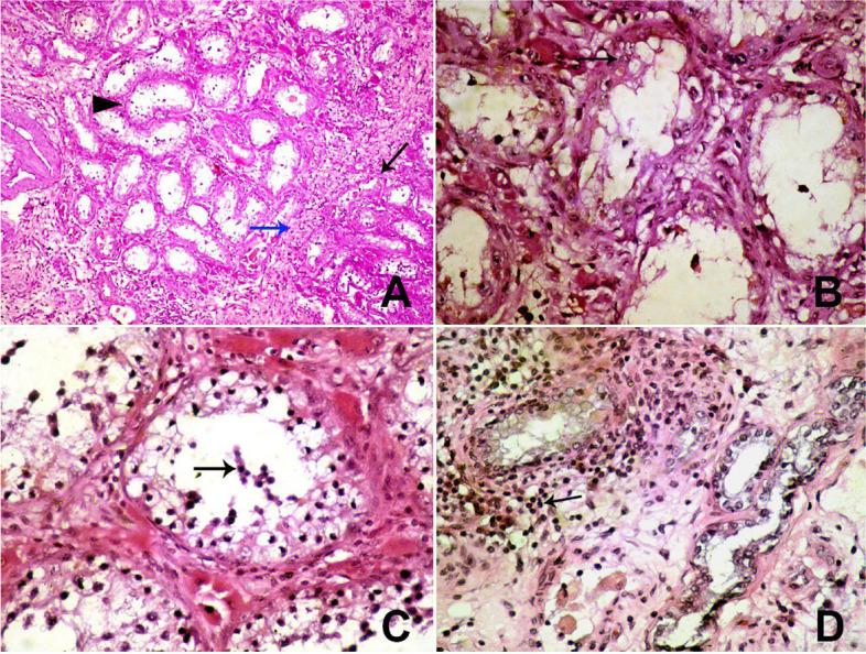 https://cdn.ncbi.nlm.nih.gov/pmc/blobs/4f54/10474774/d82222d93e8a/12917_2023_3694_Fig3_HTML.jpg