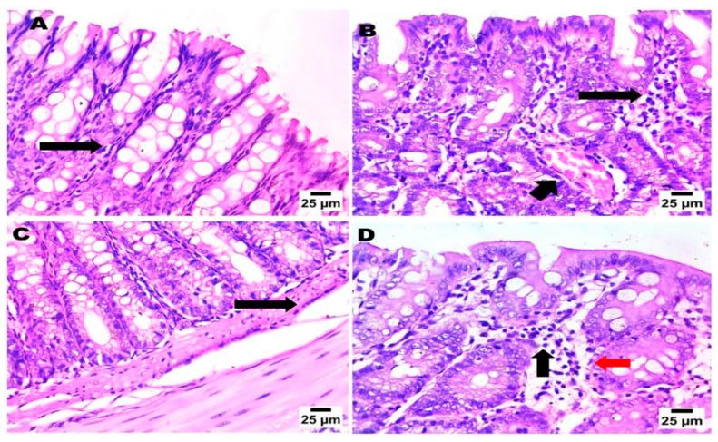 https://cdn.ncbi.nlm.nih.gov/pmc/blobs/4f59/11357403/a03339d62f30/pharmaceuticals-17-00978-g006.jpg