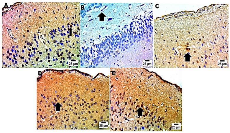 https://cdn.ncbi.nlm.nih.gov/pmc/blobs/4f59/11357403/b29846aafd27/pharmaceuticals-17-00978-g007.jpg