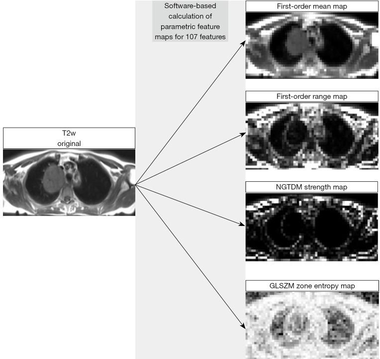 https://cdn.ncbi.nlm.nih.gov/pmc/blobs/4f5a/11170409/39d402bb6116/jtd-16-05-2875-f2.jpg