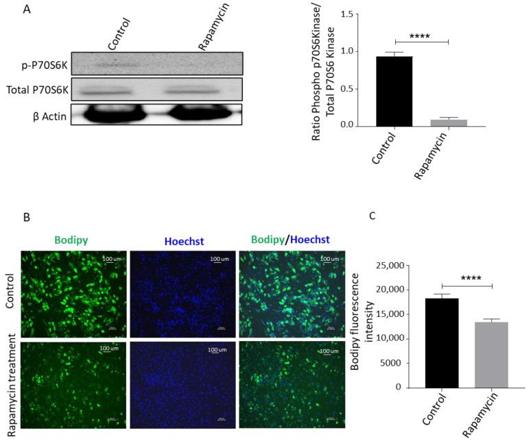 https://cdn.ncbi.nlm.nih.gov/pmc/blobs/4f5c/8698459/23483937078e/biomedicines-09-01782-g006a.jpg