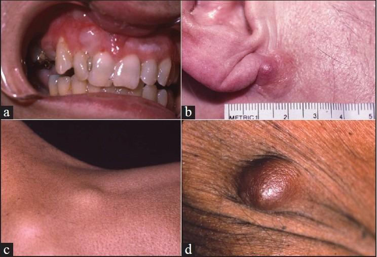 https://cdn.ncbi.nlm.nih.gov/pmc/blobs/4f5d/3818821/253e72b4fdb6/NAJMS-5-499-g001.jpg