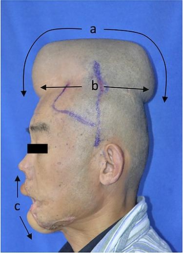 https://cdn.ncbi.nlm.nih.gov/pmc/blobs/4f5d/7175765/2142df6ecc2b/tkaa005f1.jpg