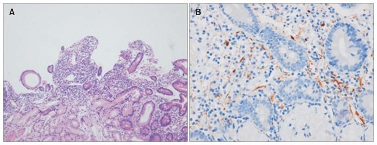 https://cdn.ncbi.nlm.nih.gov/pmc/blobs/4f5e/6034675/83503187c09d/jnm-24-345f1.jpg