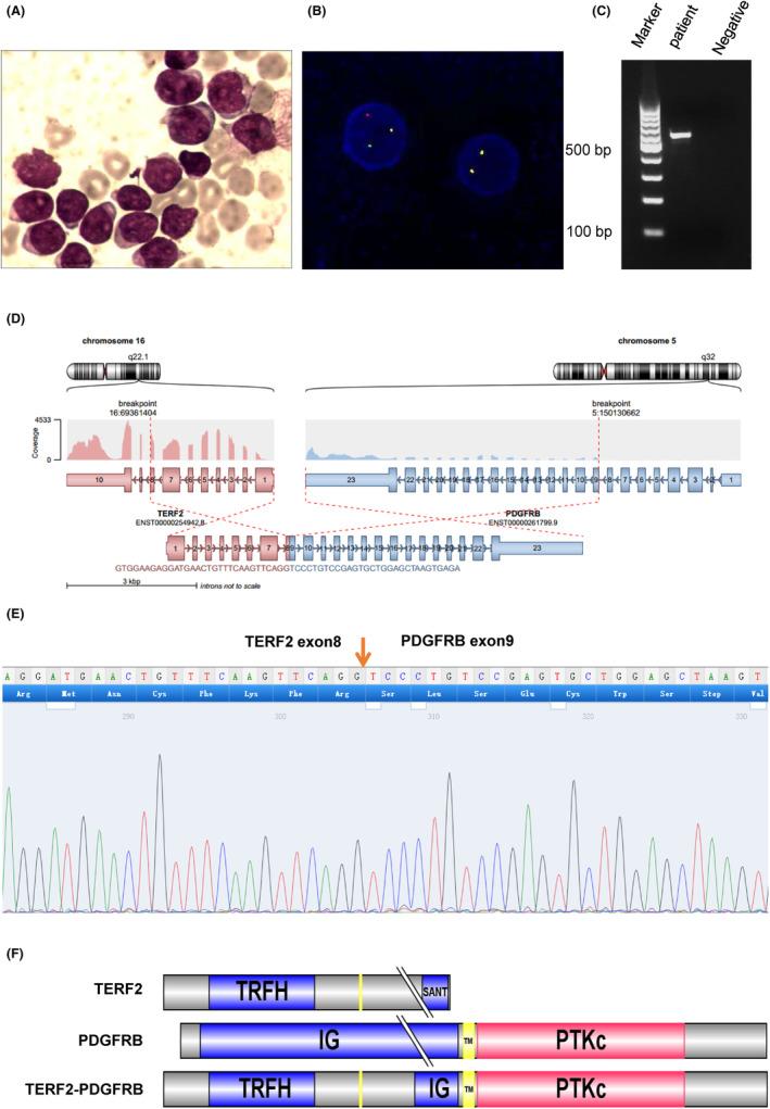 https://cdn.ncbi.nlm.nih.gov/pmc/blobs/4f61/10844707/3460aae34fca/JCMM-28-e18114-g001.jpg