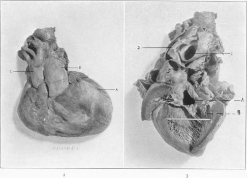 https://cdn.ncbi.nlm.nih.gov/pmc/blobs/4f64/1911060/caa868b66344/amjpathol00363-0147-b.jpg