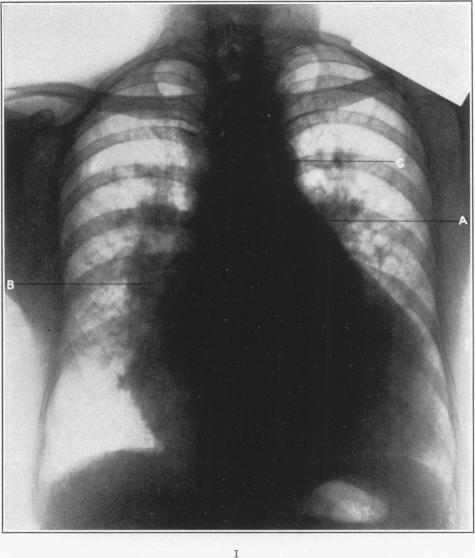 https://cdn.ncbi.nlm.nih.gov/pmc/blobs/4f64/1911060/ef930ed7b285/amjpathol00363-0147-a.jpg