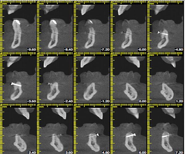 https://cdn.ncbi.nlm.nih.gov/pmc/blobs/4f65/5750831/921eee1e3fc2/jiufd-051-s076-e014.jpg