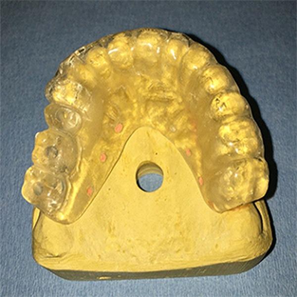 https://cdn.ncbi.nlm.nih.gov/pmc/blobs/4f65/5750831/932c55054e6e/jiufd-051-s076-e010.jpg