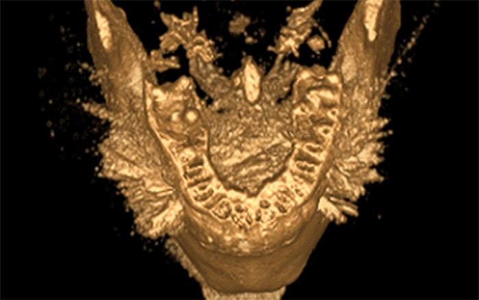 https://cdn.ncbi.nlm.nih.gov/pmc/blobs/4f65/5750831/a0fa6e47f42d/jiufd-051-s076-e009.jpg
